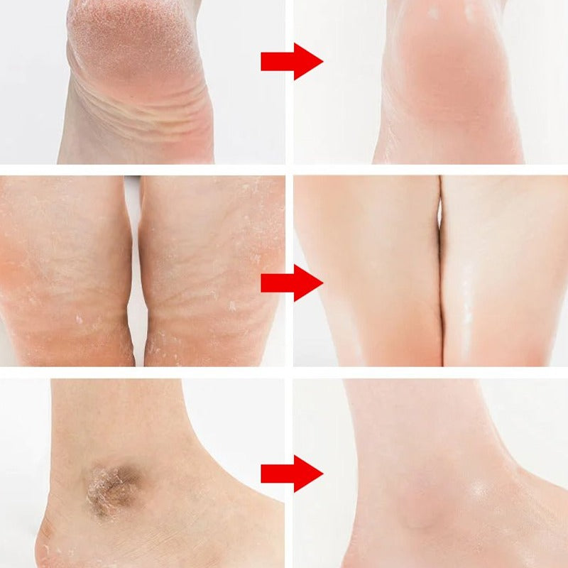 Electric Grinder For Feet